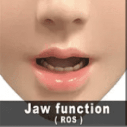 ソフトヘッド ROS付き